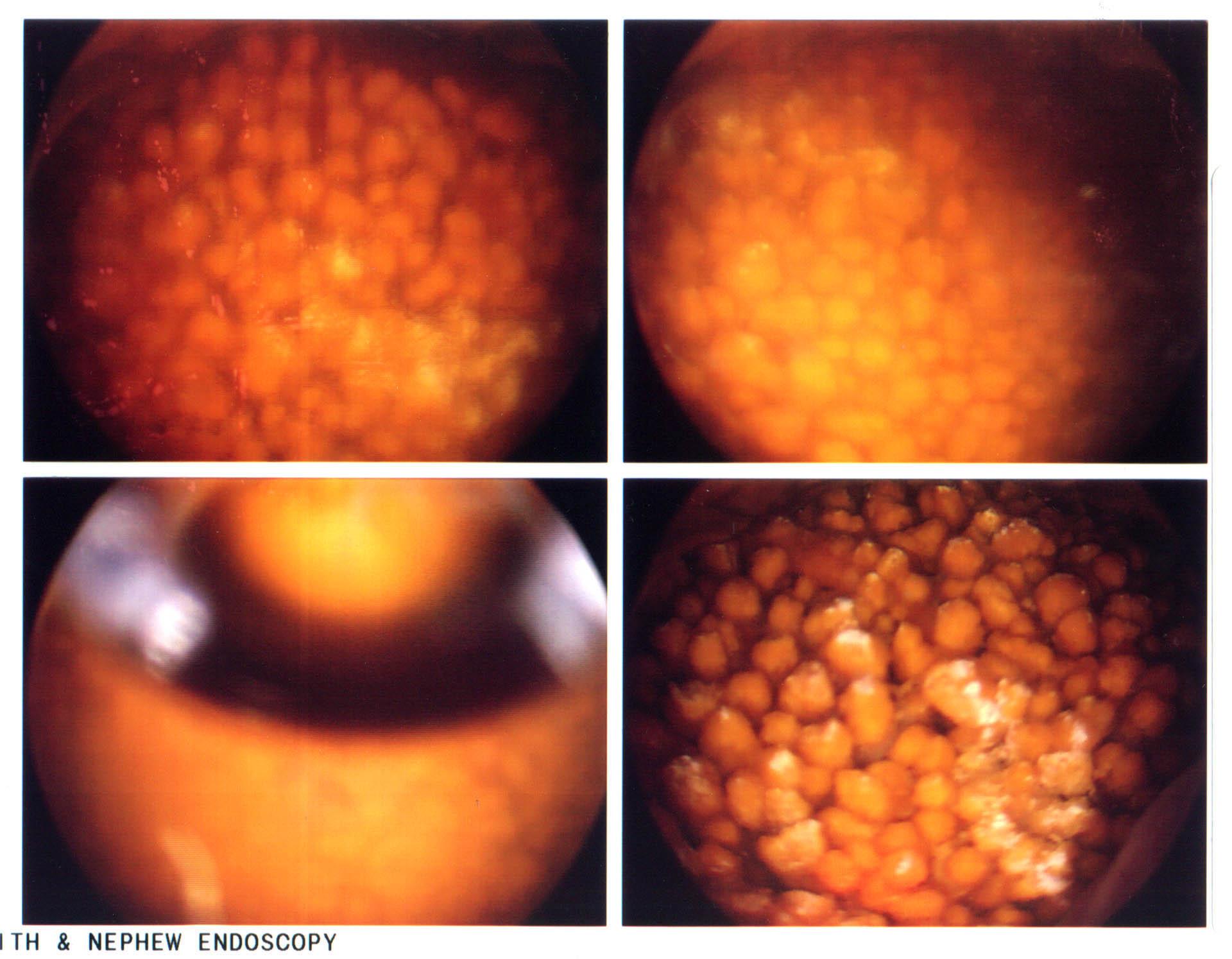 Photos of the stone from different angles.